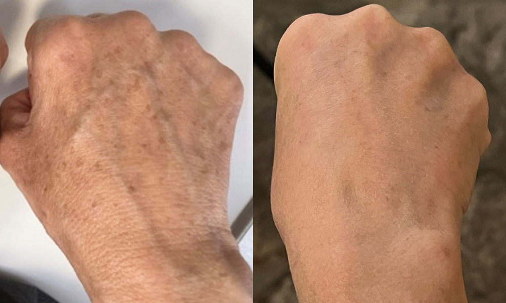Hands Before and After